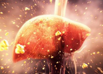 Riêng tư: Gan nhiễm mỡ là gì? 6 điều bạn cần biết về căn bệnh nguy hiểm này