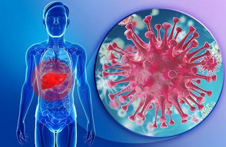 Bệnh viêm gan C – nguyên nhân, triệu chứng và hướng điều trị mới nhất hiện nay được nhiều chuyên gia ủng hộ